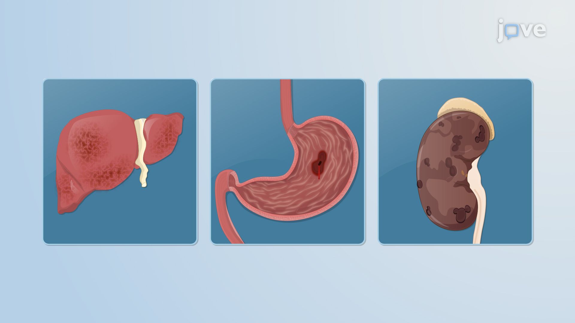 Drug Toxicity: Overview