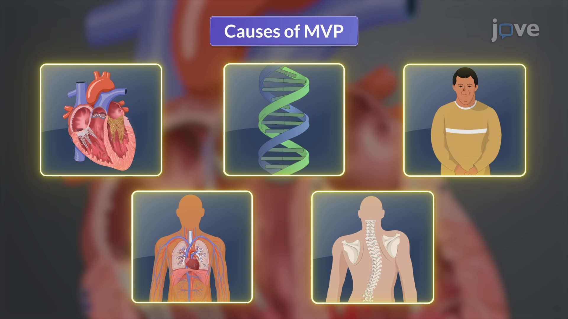Mitral Valve Prolapse I: Introduction