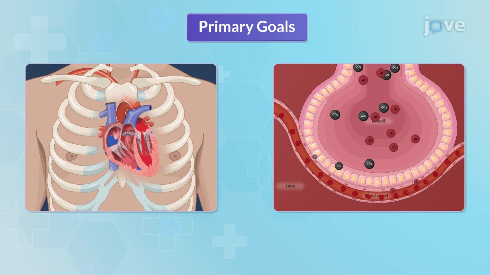 Mitral Regurgitation IV: Nursing Management