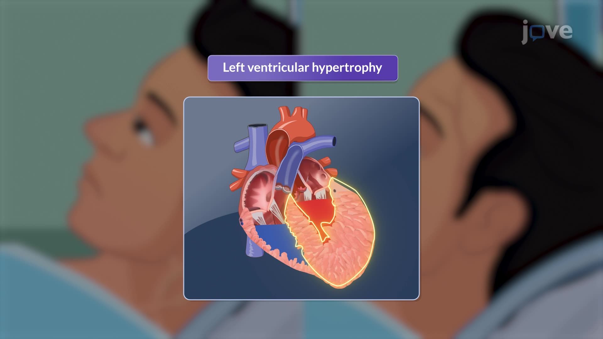 Aortic Regurgitation II: Clinical Features and Diagnostic Tests