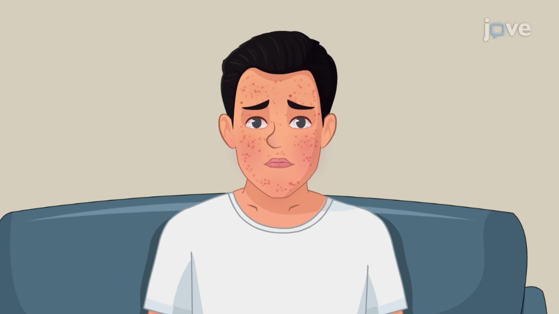 Endocarditis II: Clinical Features of Infective Endocarditis