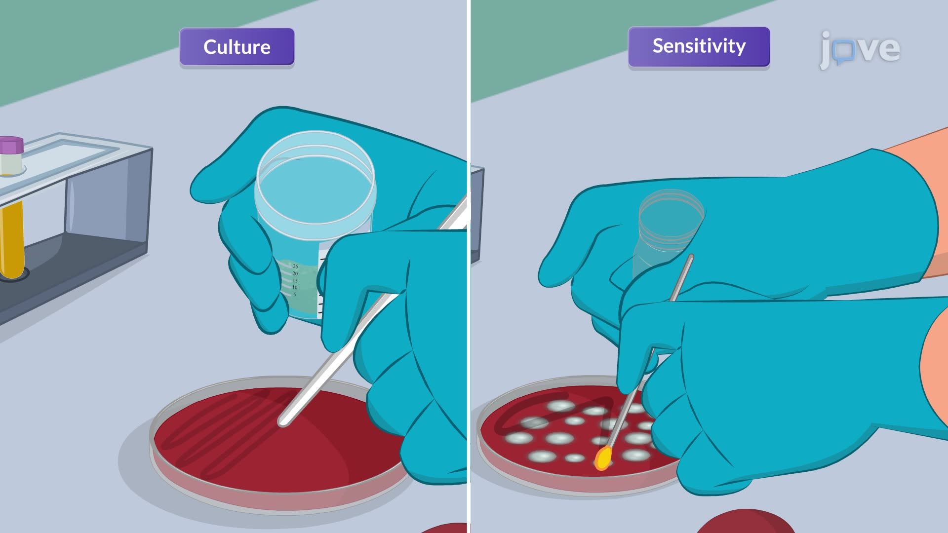 Endocarditis III: Medical Management
