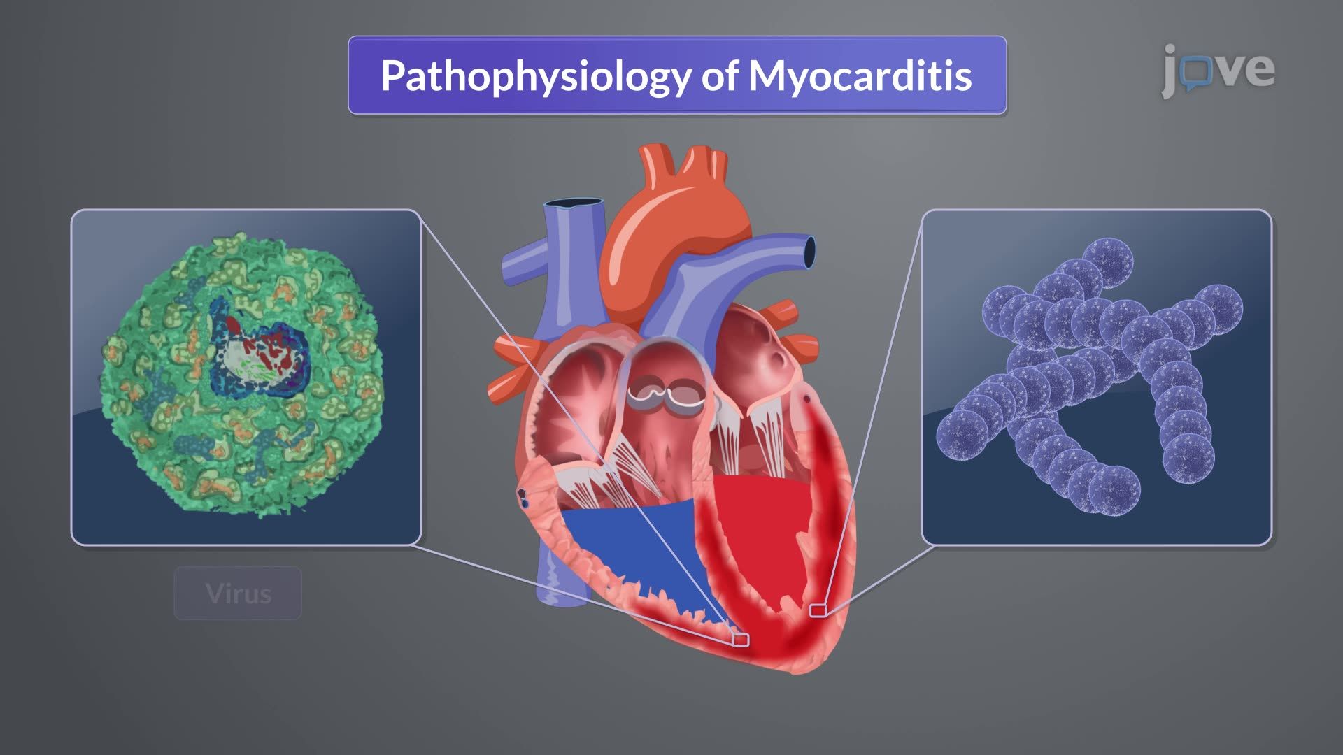 Myocarditis I: Introduction