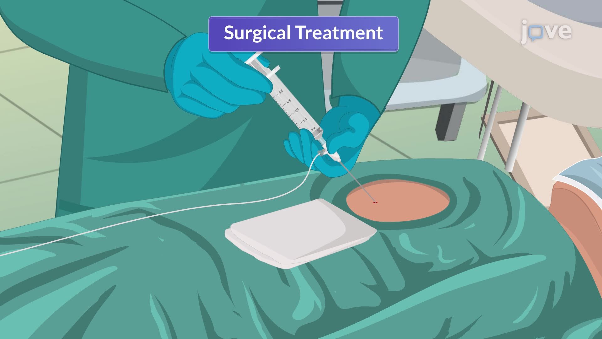 Pericarditis III: Medical Management