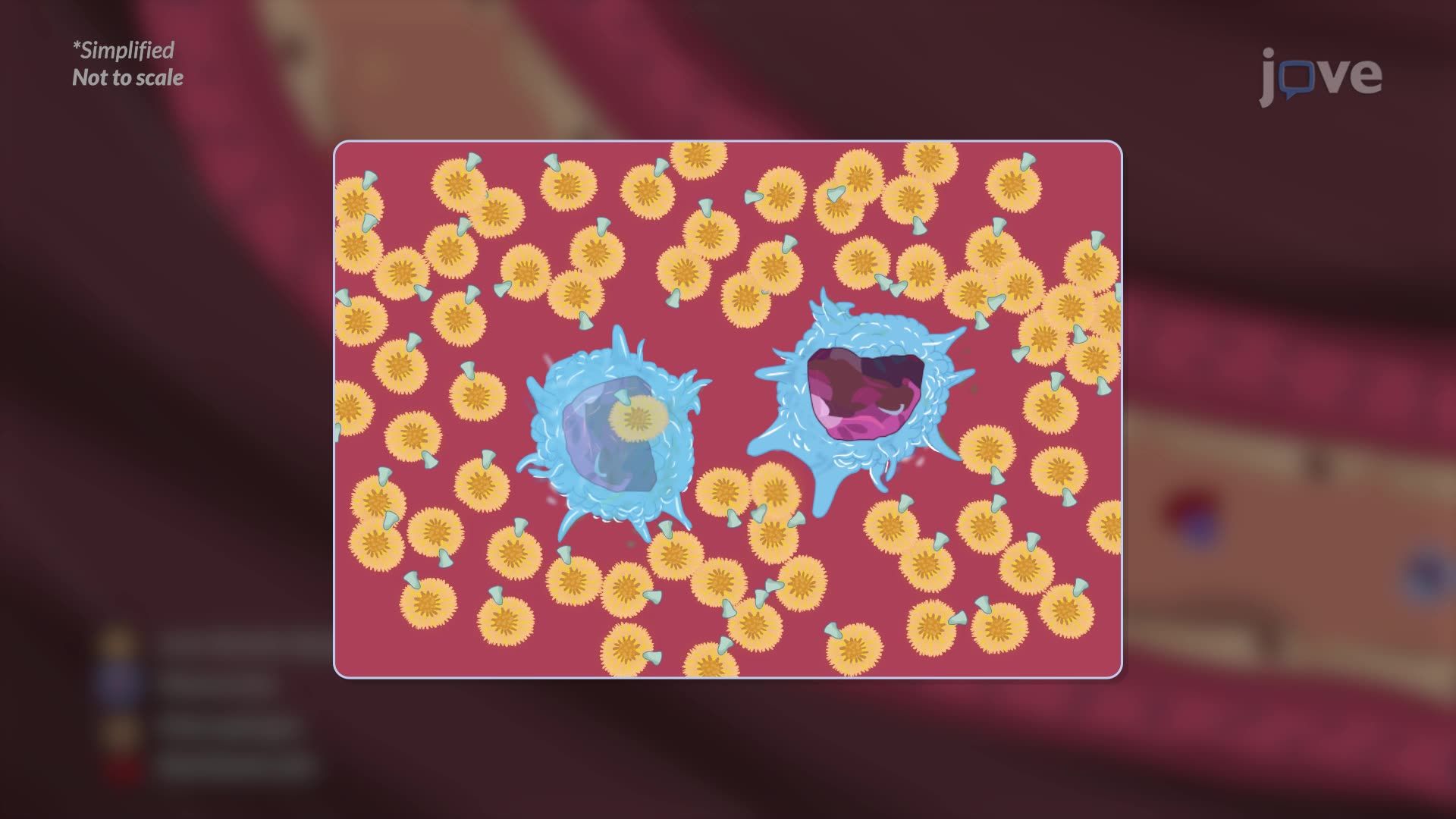 Coronary Artery Disease II: Pathophysiology
