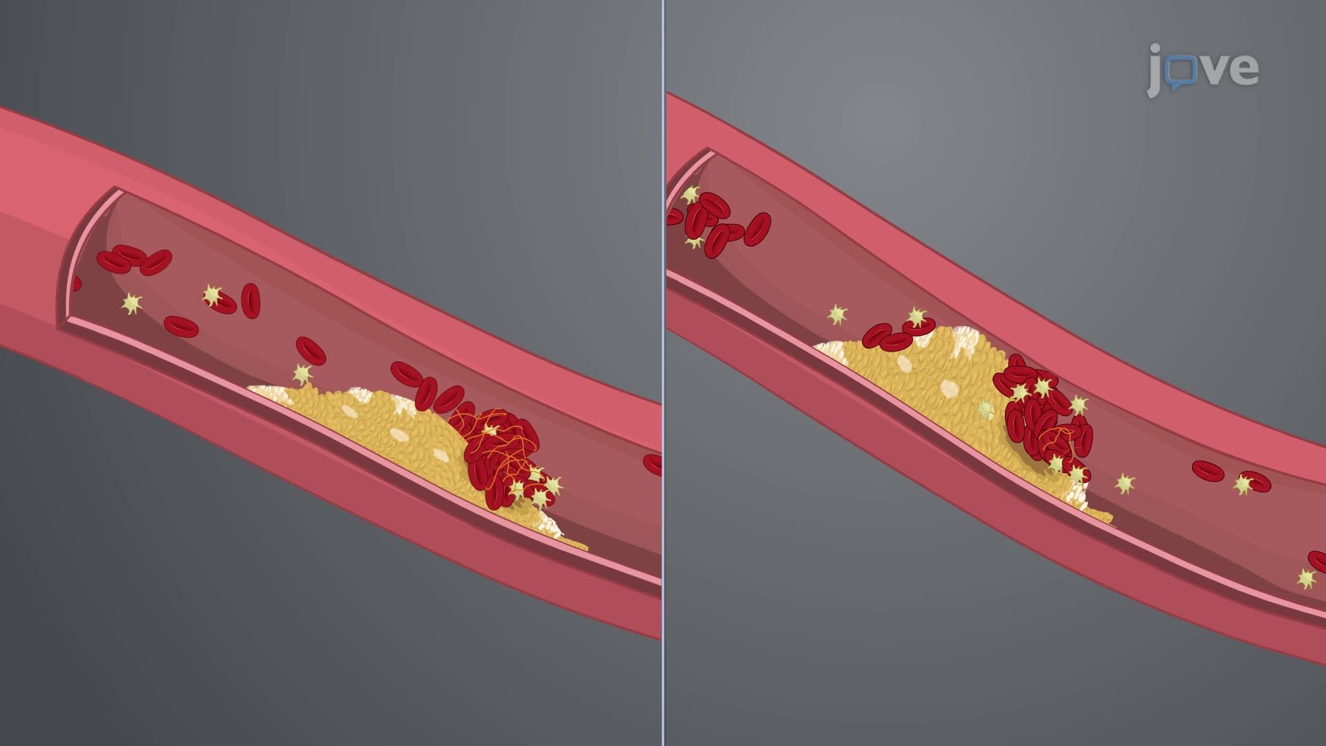 Acute Coronary Syndrome I: Introduction