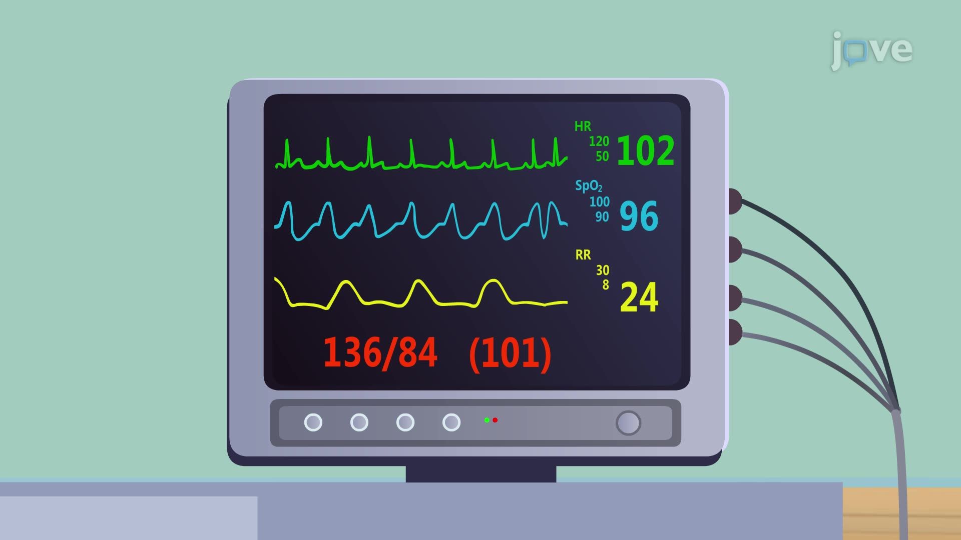 Angina V: Nursing Management