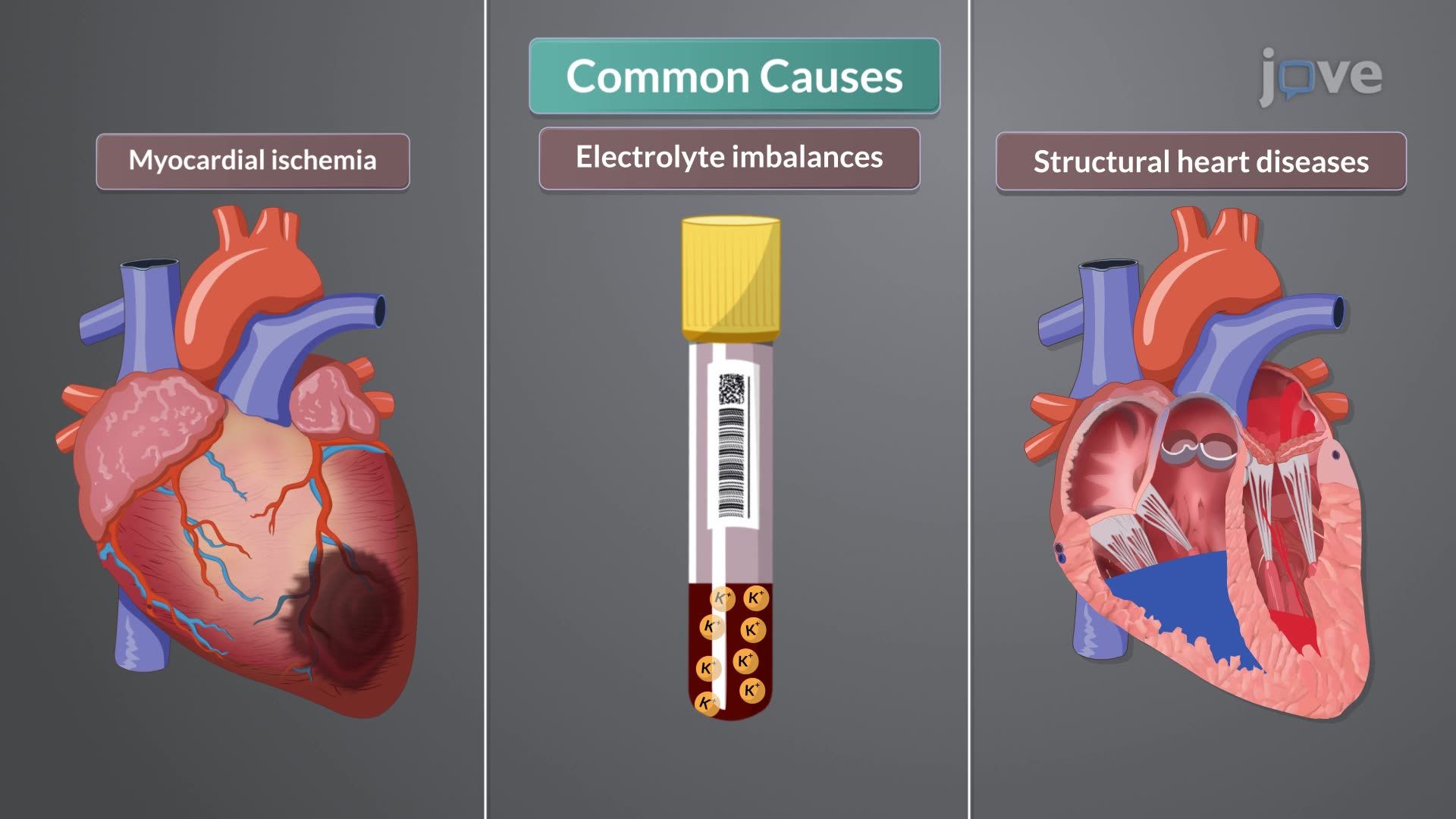 Dysrhythmias I: Introduction