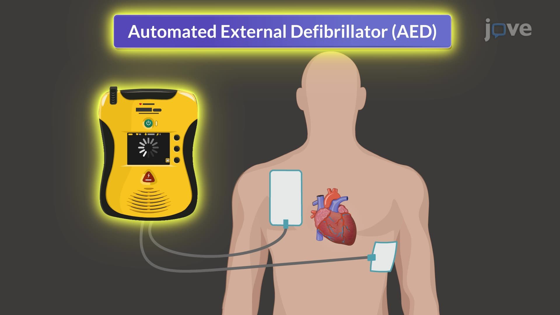 Cardiopulmonary Resuscitation III:  AED Use