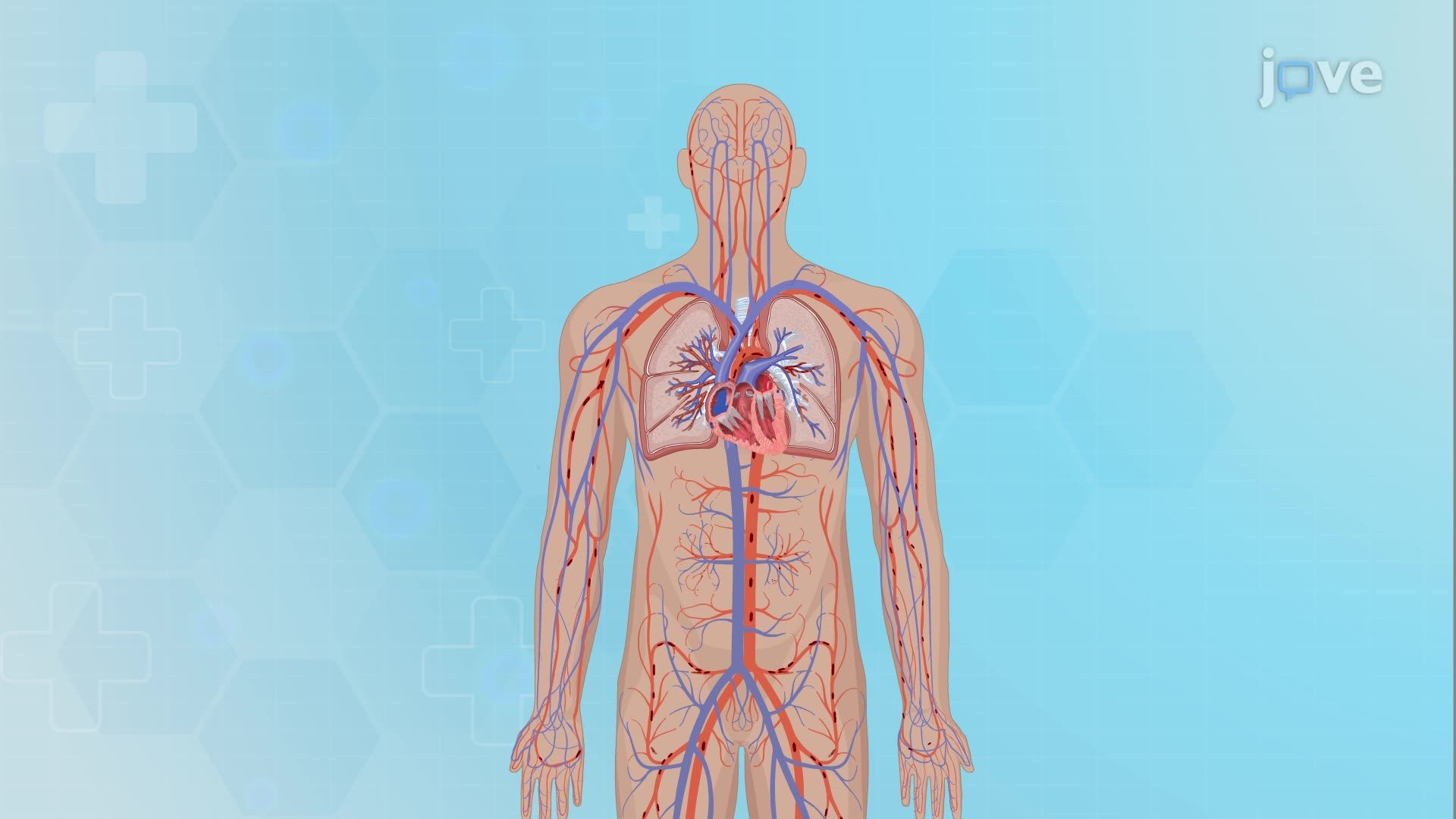 Heart Failure I: Introduction
