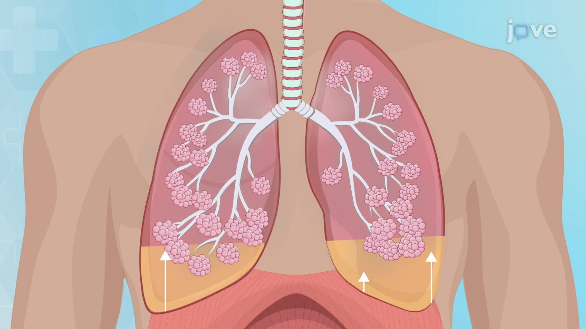 Heart Failure V: Medical Management