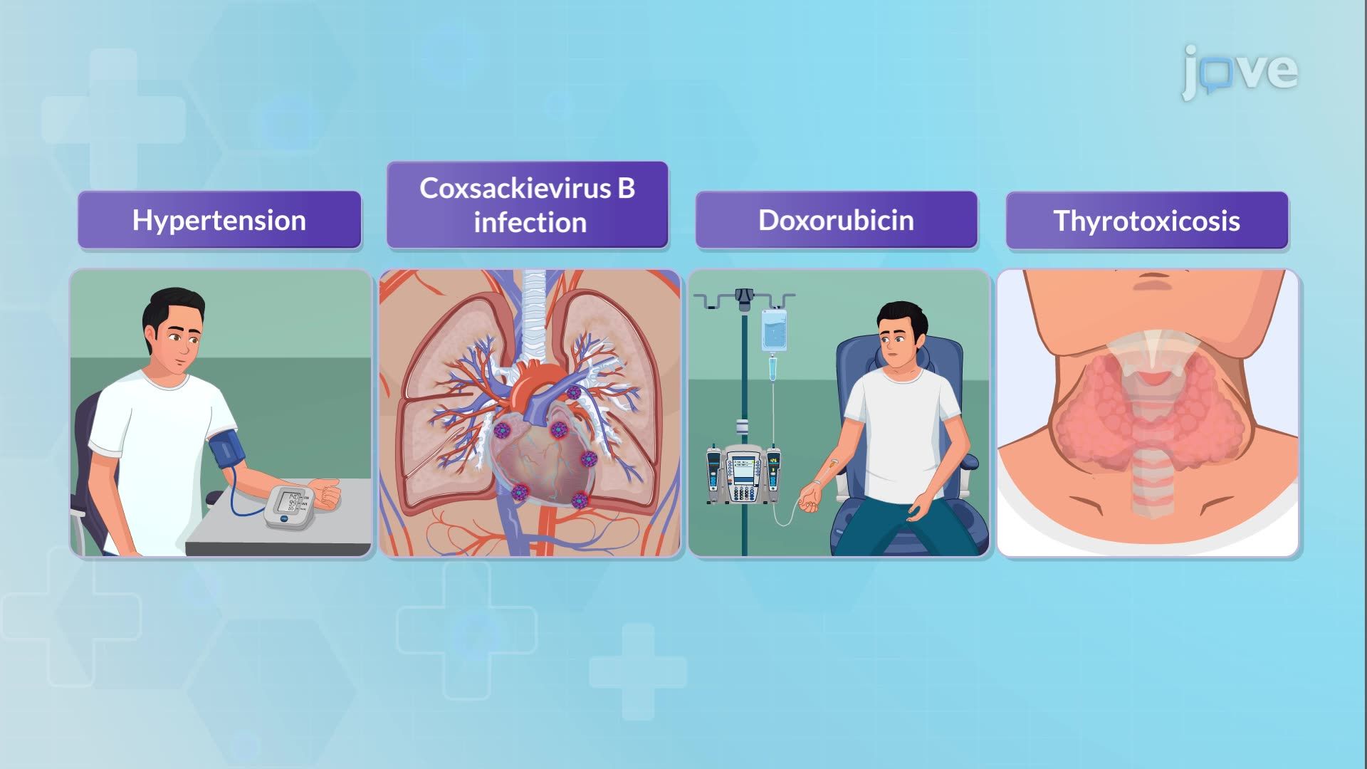 Cardiomyopathy II: Dilated Cardiomyopathy