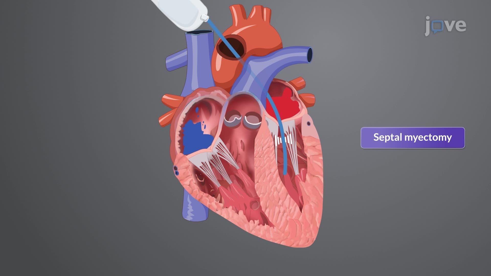 Cardiomyopathy V: Interprofessional Care