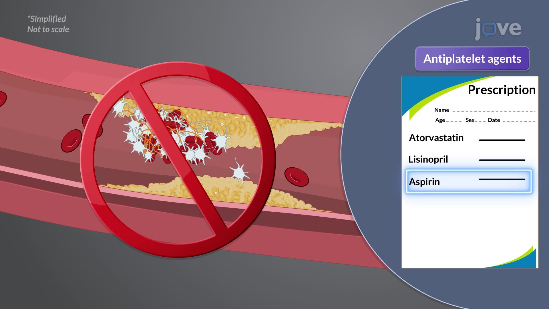 Atherosclerosis III: Management