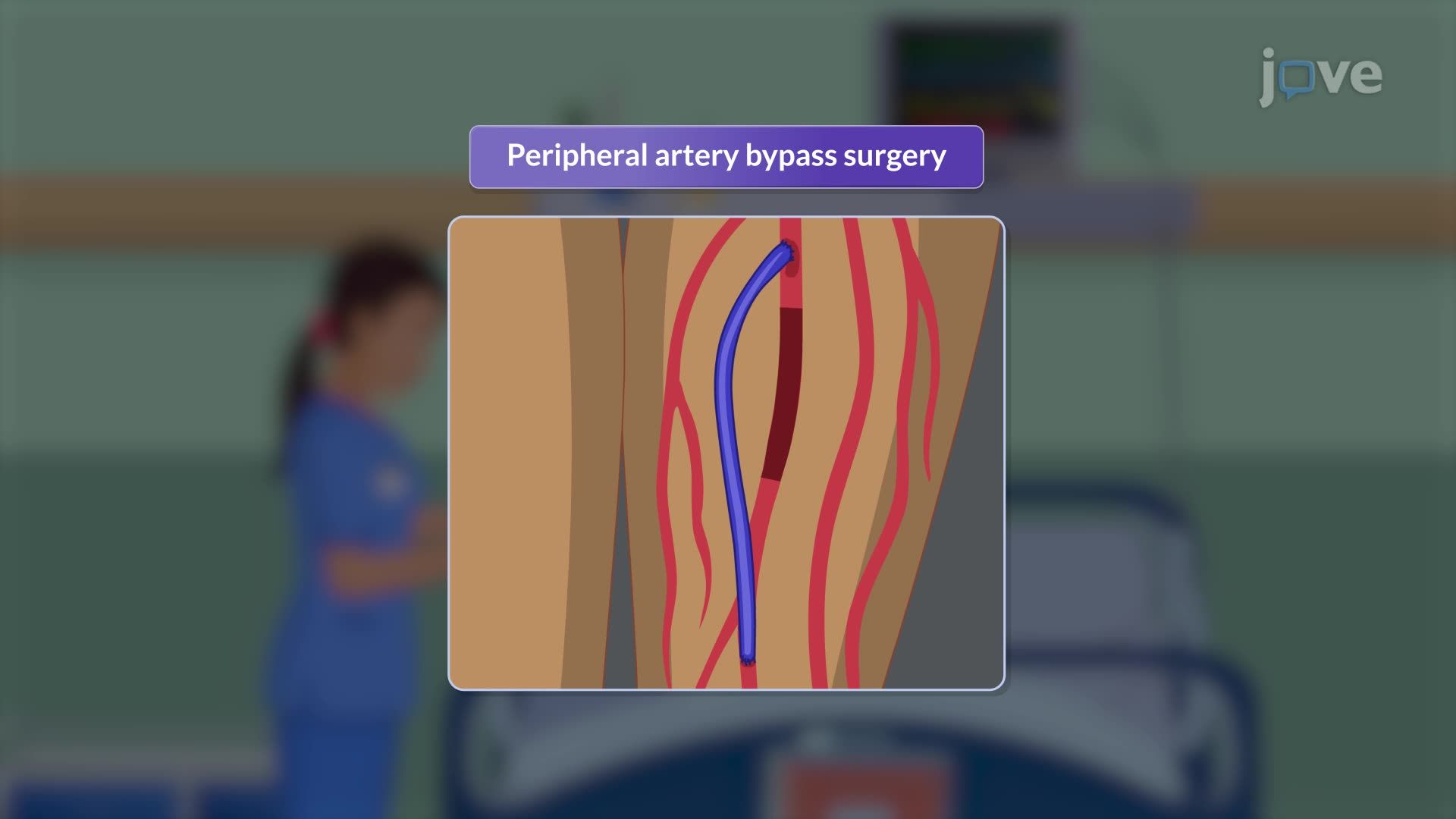 Peripheral Artery Disease V: Postoperative Nursing Management