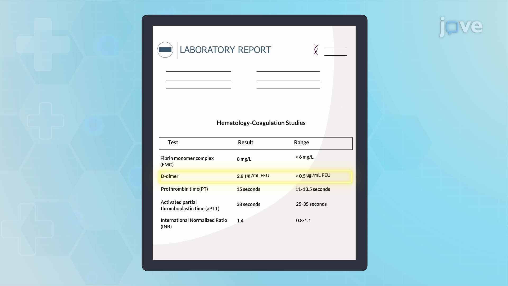 Venous Thrombosis II: Clinical Manifestations and Diagnostic Studies