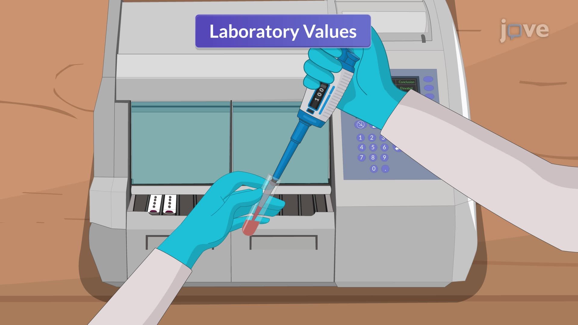 Pulmonary Embolism III: Nursing Management