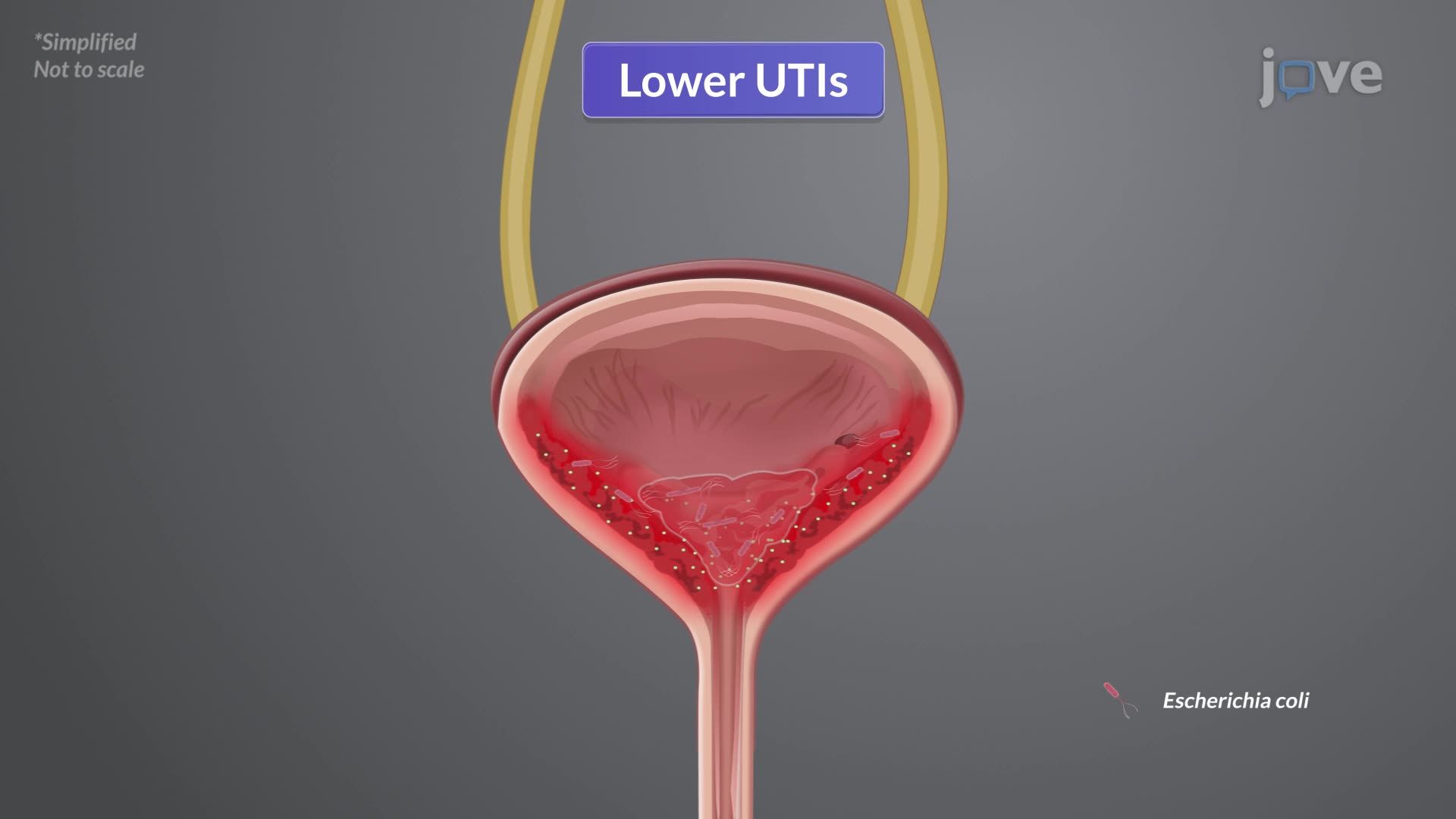 Urinary Tract Infection I: Introduction