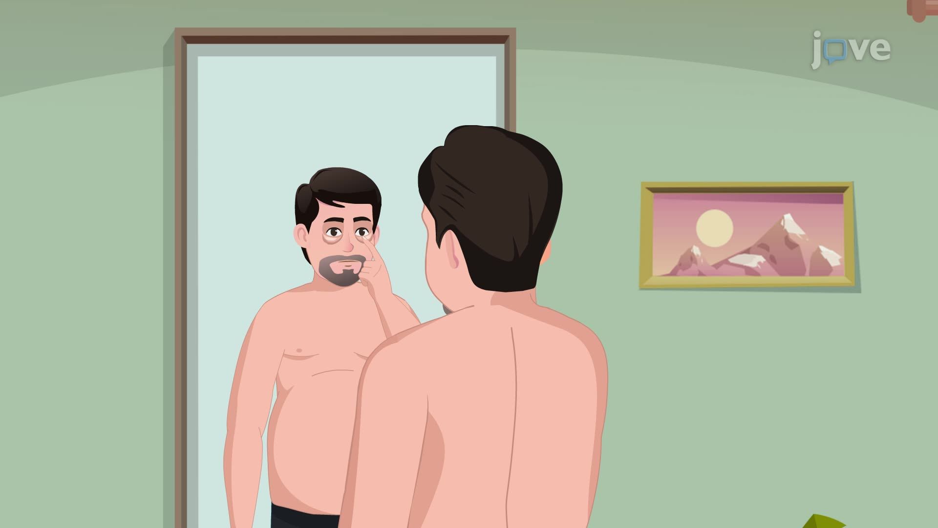 Nephrotic Syndrome I : Introduction