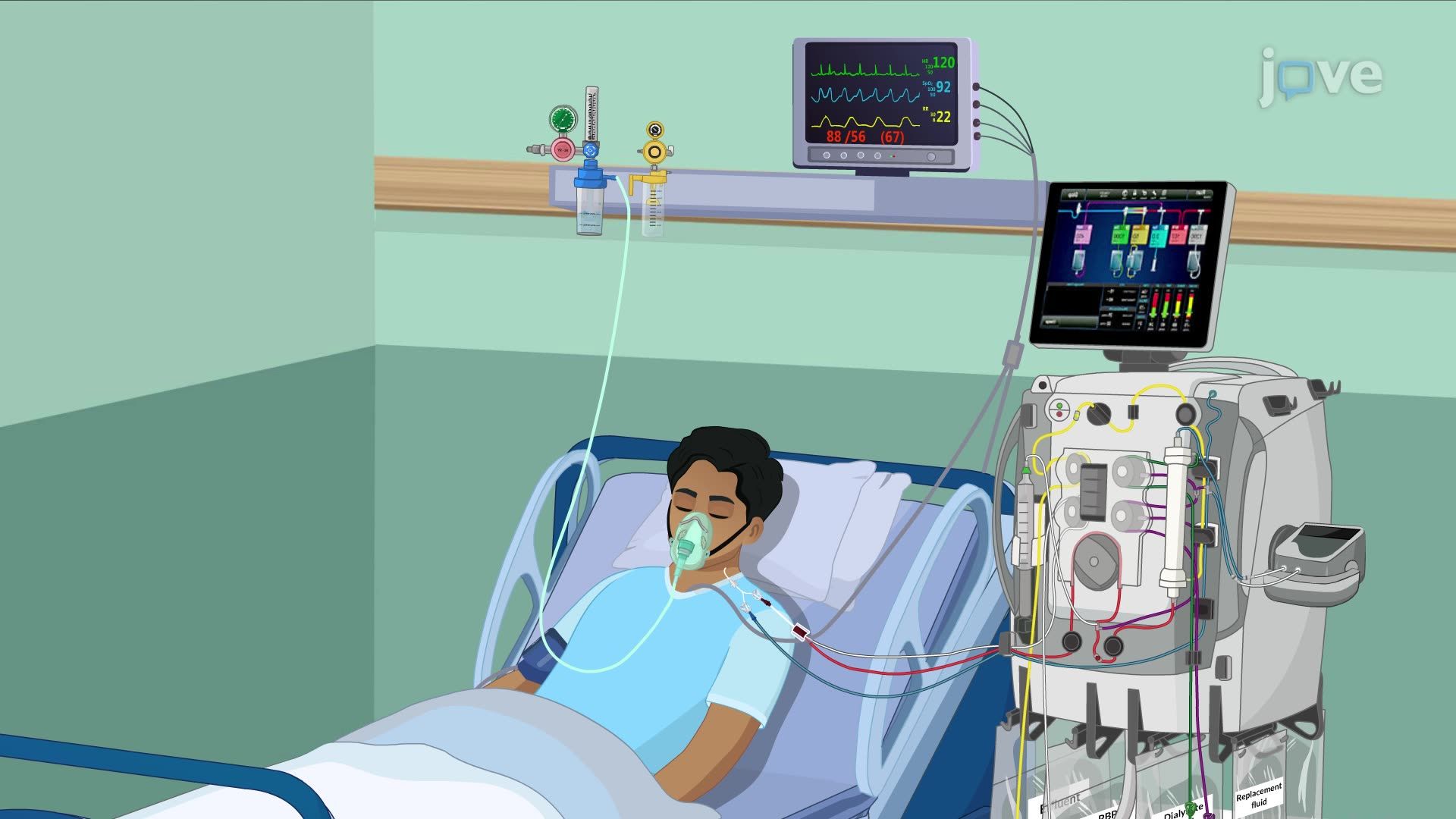 Continuous Renal Replacement Therapy