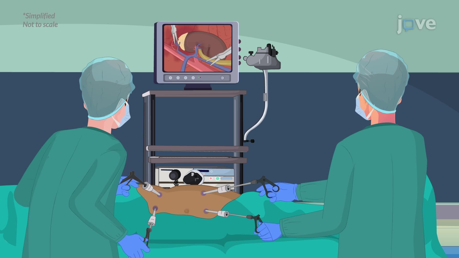 Kidney Transplant II: Surgical Procedure