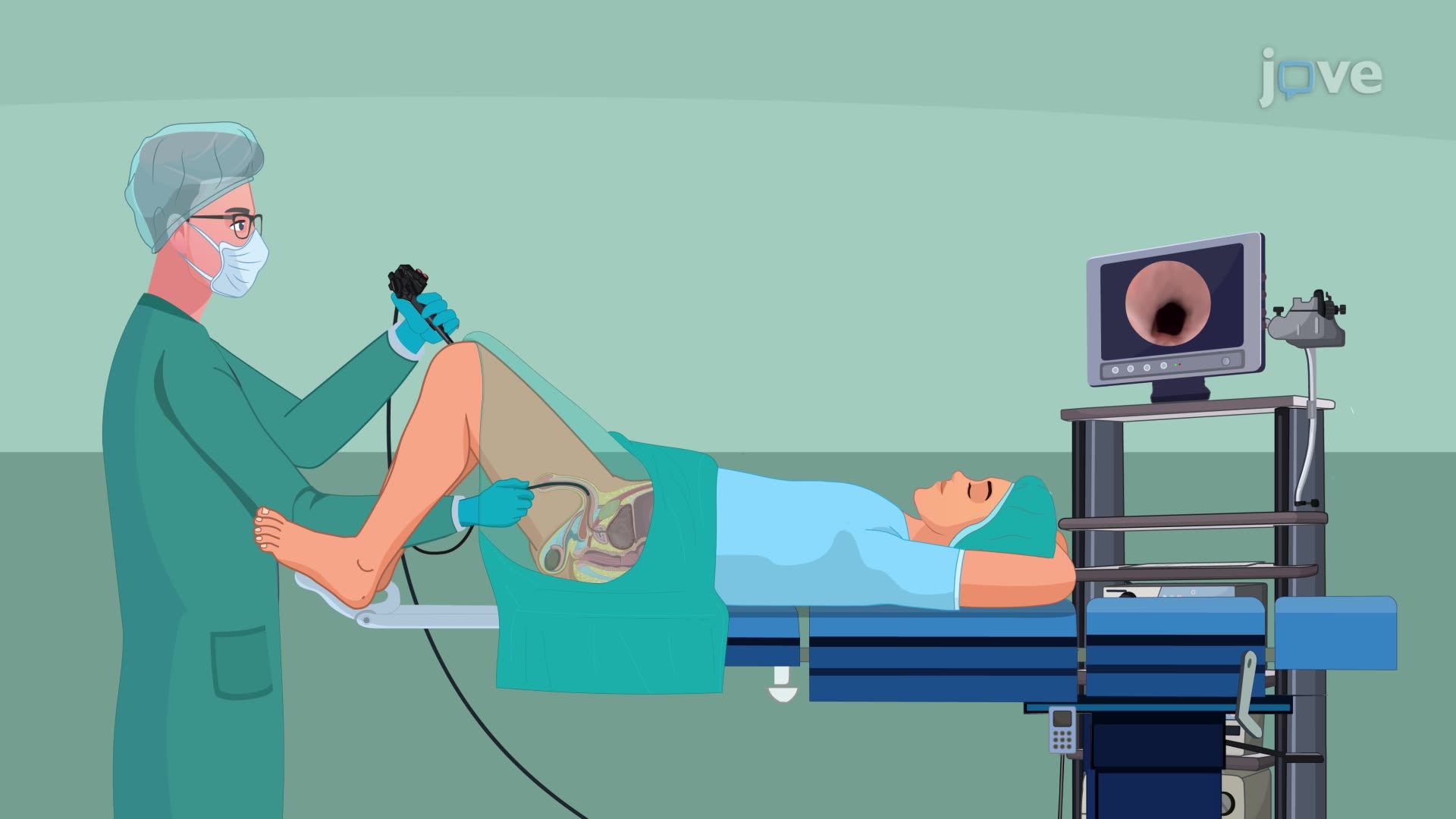 Urologic Endoscopic Procedure: Cystoscopic Examination