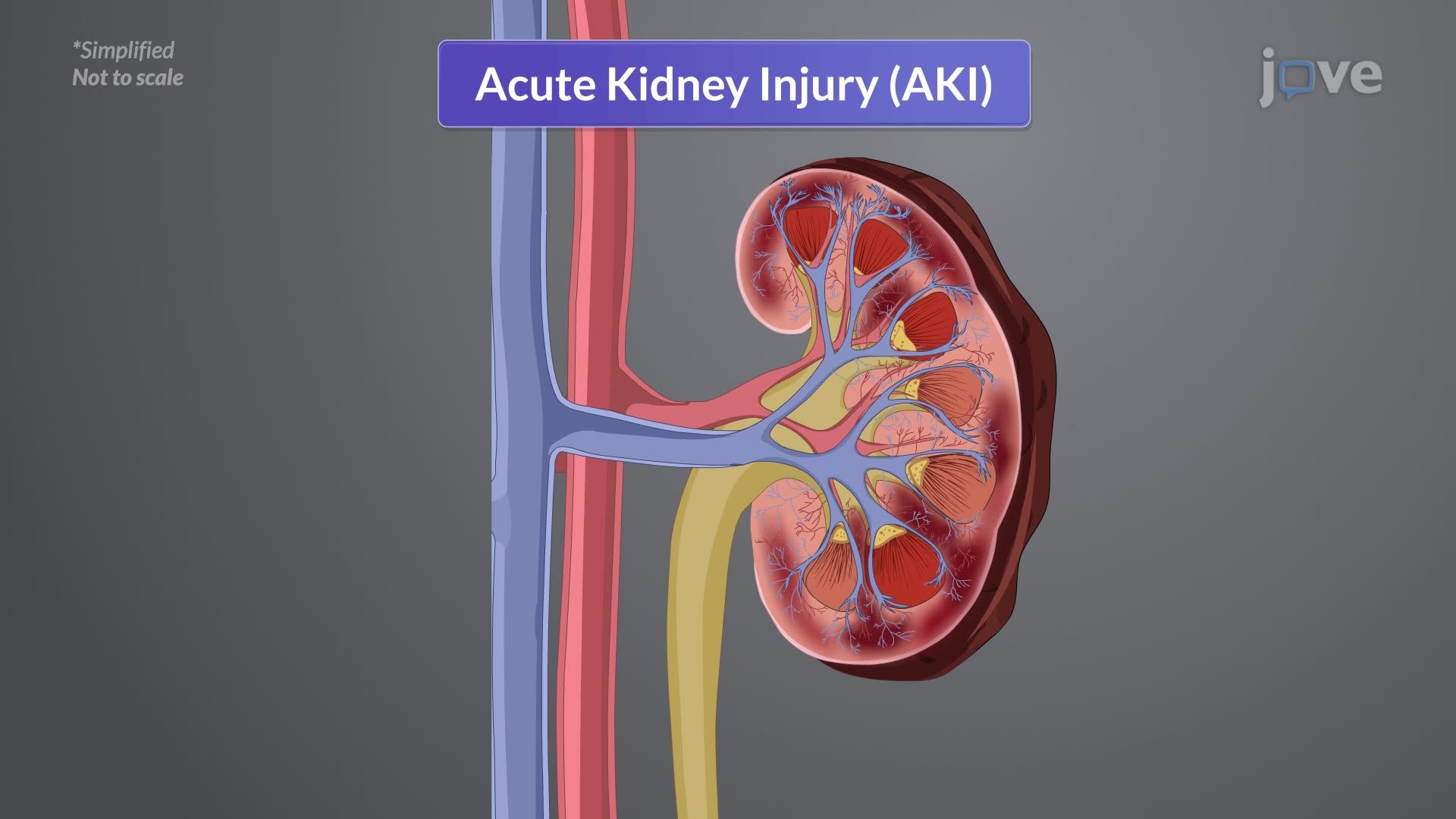 Acute Kidney Injury III: Clinical Manifestations