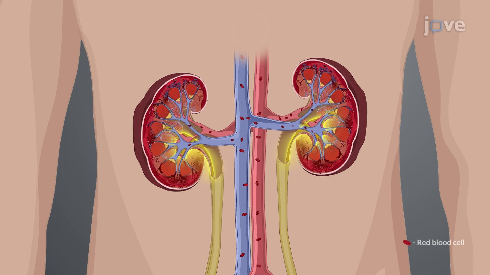 Chronic Kidney Disease I: Introduction