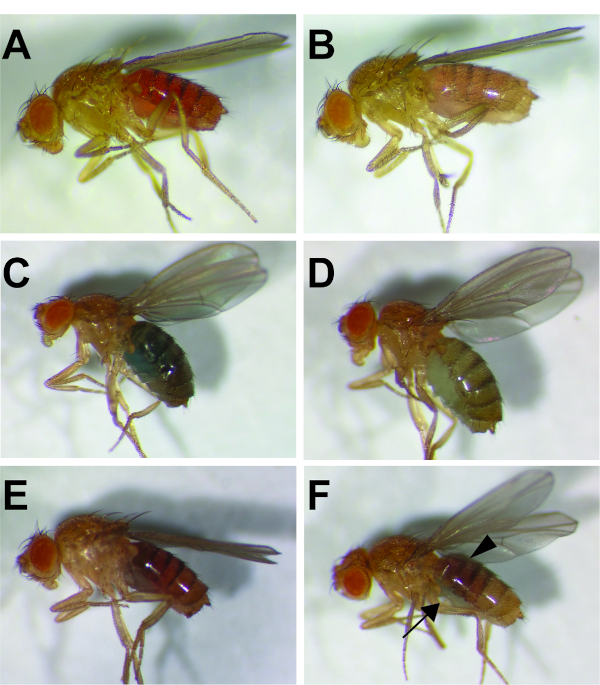 Taste Preference Assay: A Method for Measuring Feeding Behavior in  Drosophila