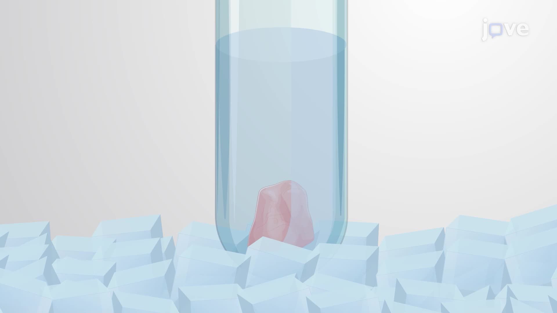 Detecting Neurodegenerative Disease-Associated Protein α-Synuclein Using ELISA