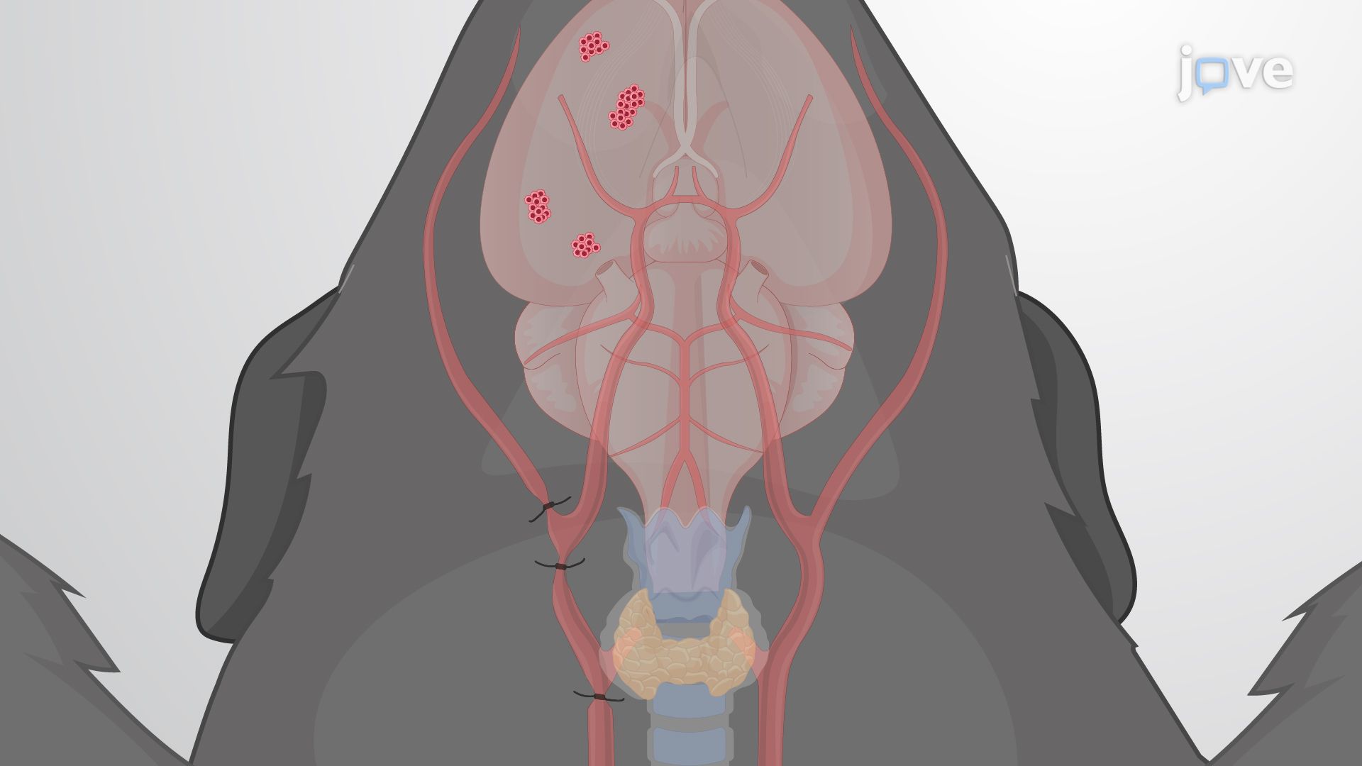 Modeling Brain Tumor Metastasis via Internal Carotid Artery Injection of Cancer Cells