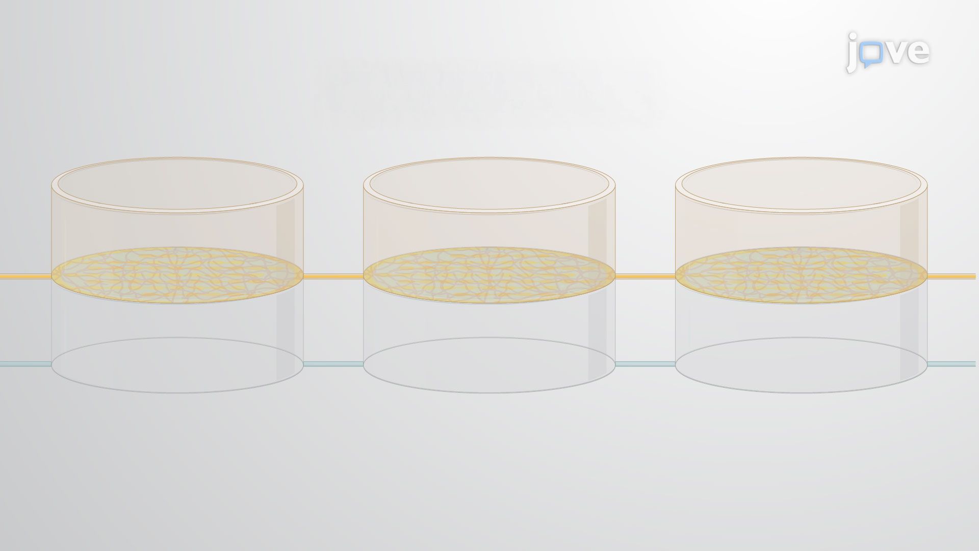 Impedance-Based Measurements of Brain Cancer Cell Invasion