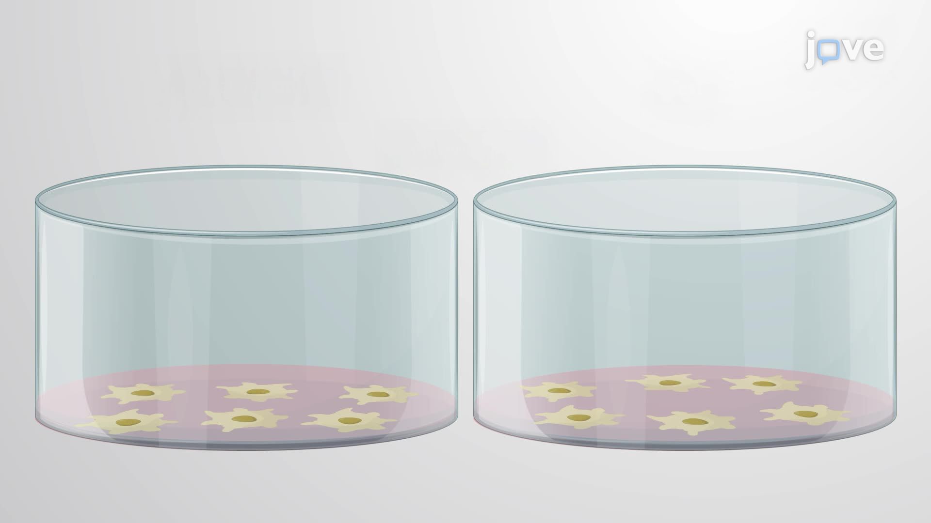 Live-cell Phagocytosis Assay of Microglia-Like Cells Using Human Synaptosomes