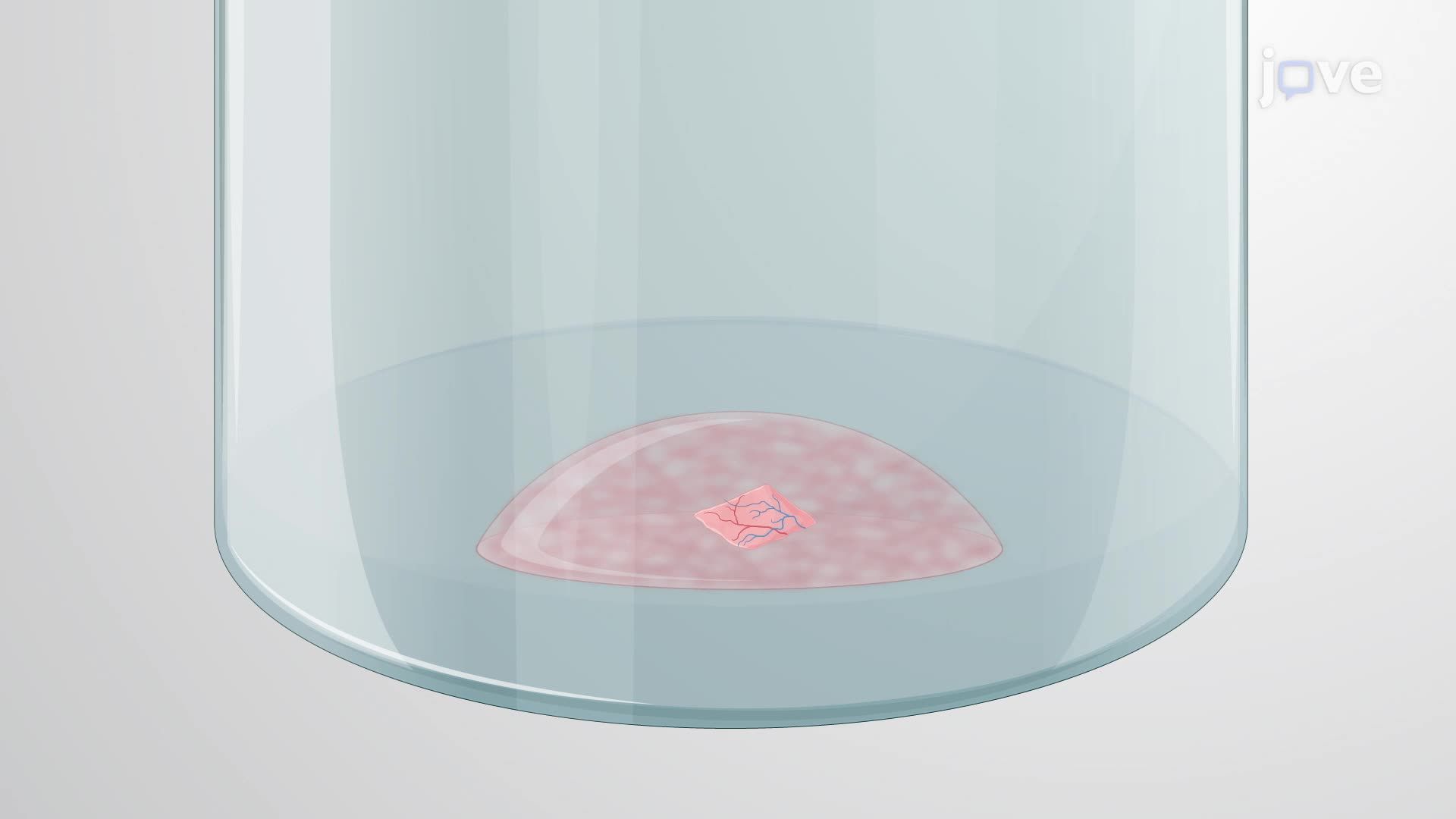 Immunofluorescence Staining of Gel-Embedded Patient-Derived Diseased Fibrovascular Tissue