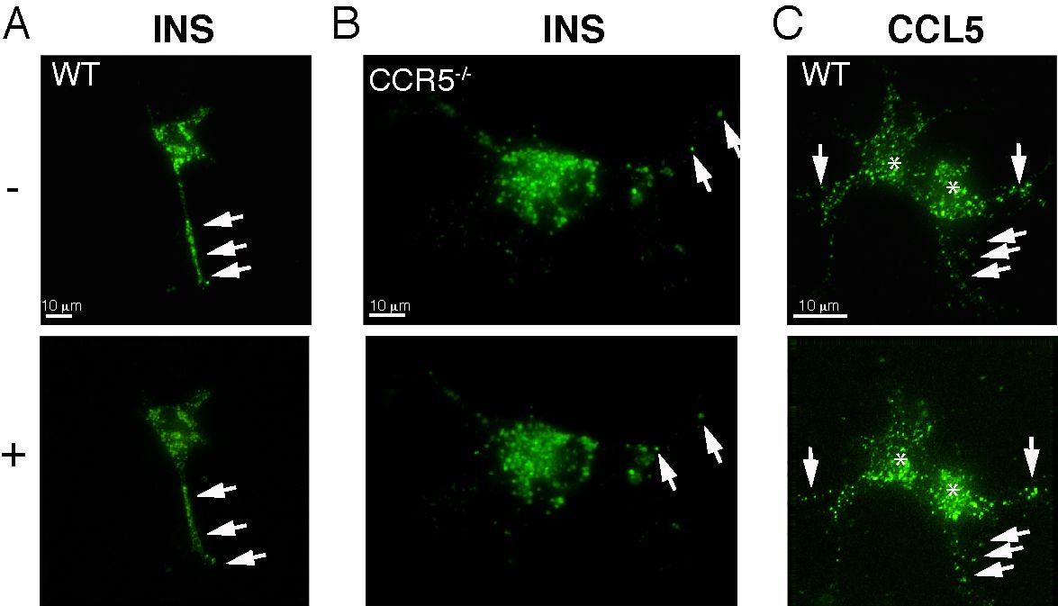Microscopy images of INS and CCL5 proteins in WT and CCR5-/- cells, fluorescence signal.