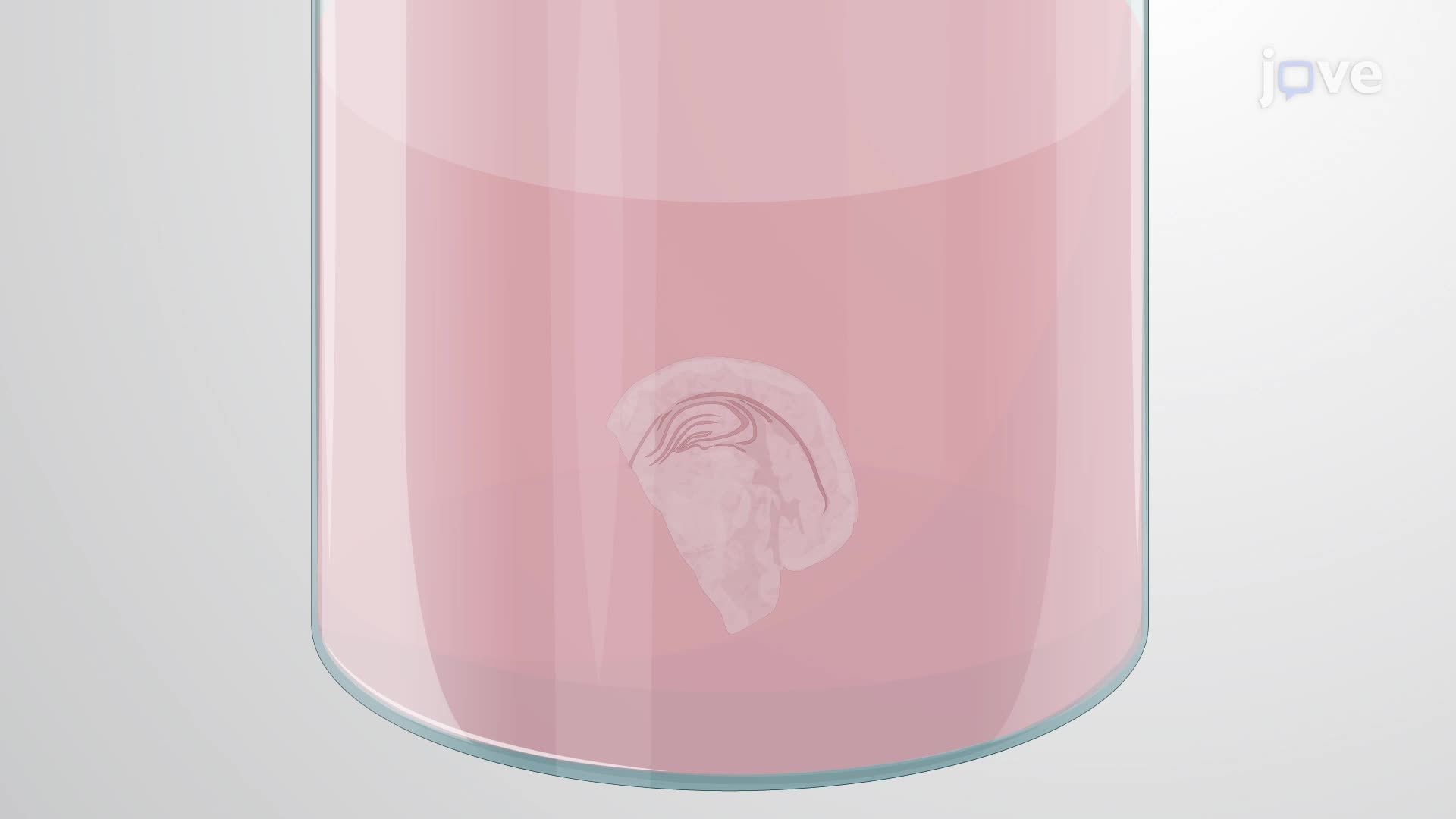 Microscopic Analysis of Synapses in Mouse Hippocampal Slices Using Immunofluorescence