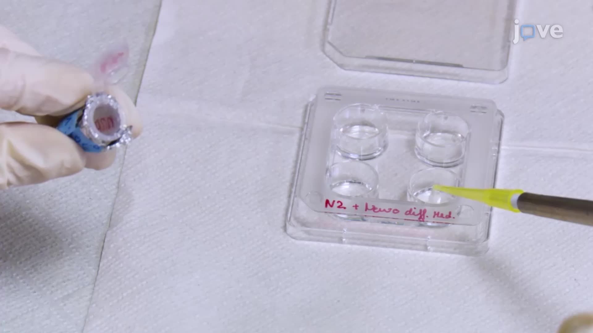 视频: Immunofluorescence Microscopy of Neural Cells Differentiated from ...
