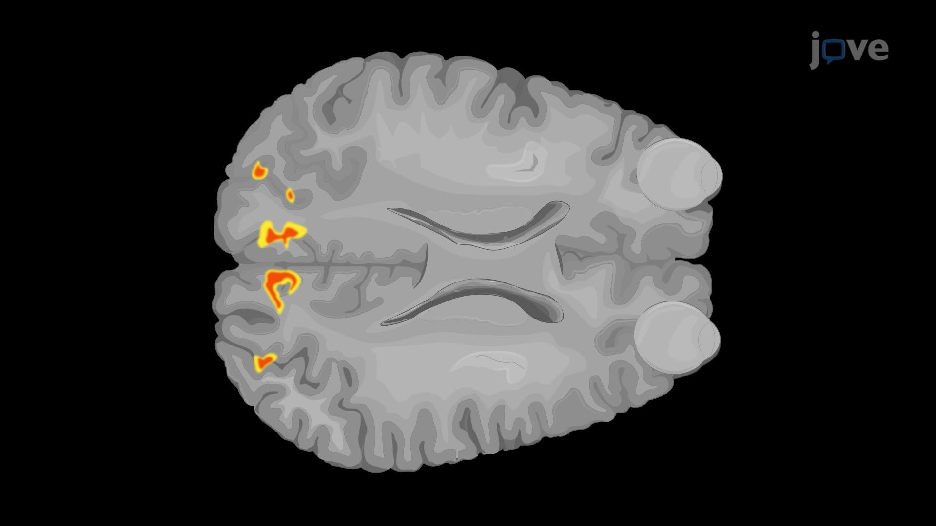 Blood Oxygen Level-Dependent Functional Magnetic Resonance Imaging of the Visual Cortex