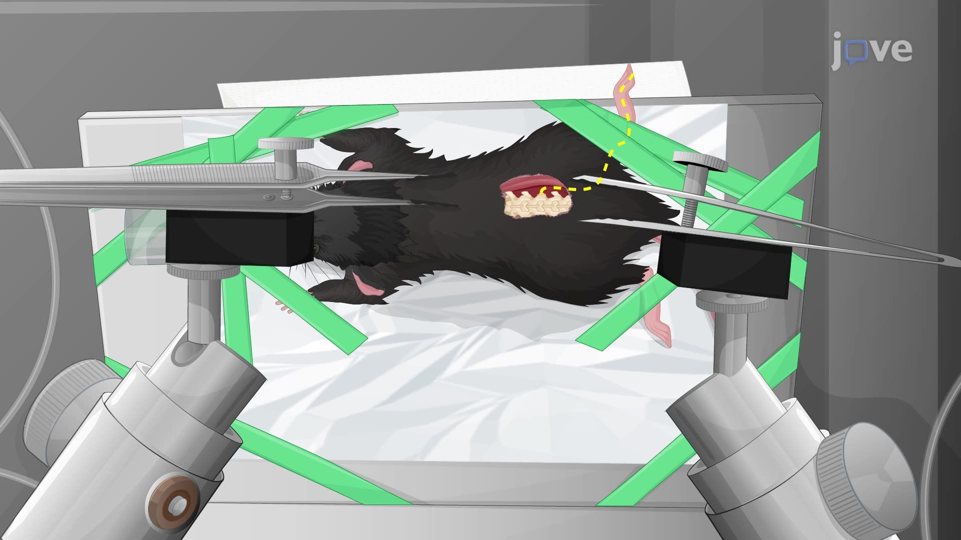 In Vivo Calcium Imaging of Neuronal Ensembles in the Intact Dorsal Root Ganglia of a Mouse