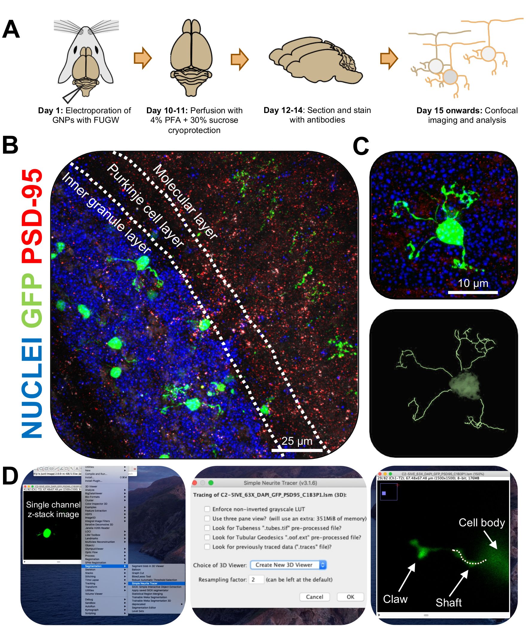 Cerebellum electroporation diagram, confocal imaging; neuron analysis and tracing, z-stack software.