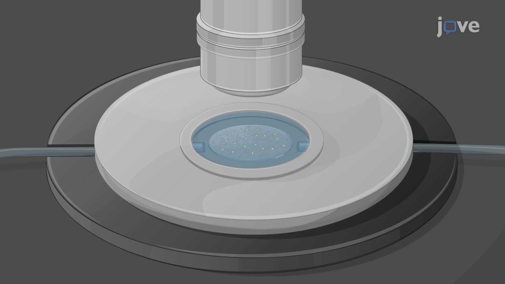 In Vitro Calcium Imaging in Short-Term and Long-Term Rat Hippocampal Cultures