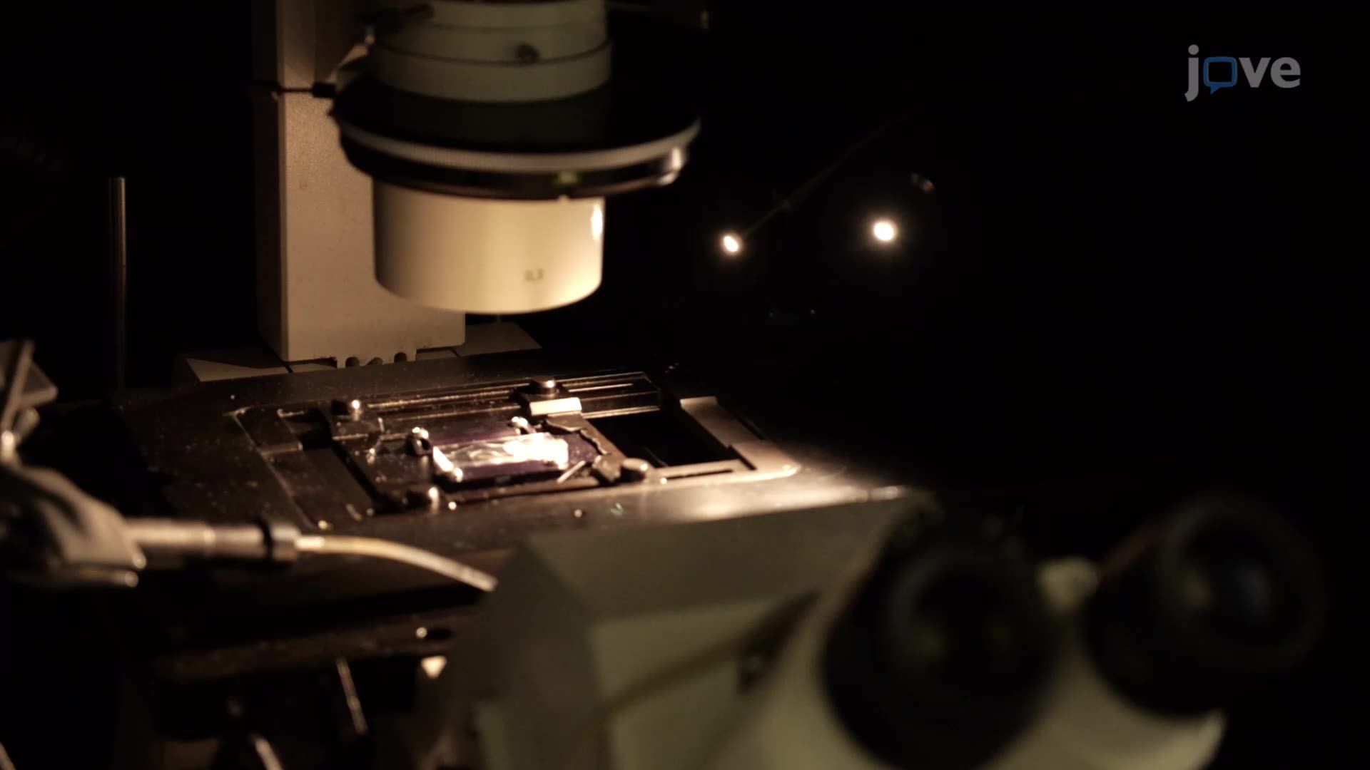 In Vitro Calcium Imaging in Short-Term and Long-Term Rat Hippocampal Cultures