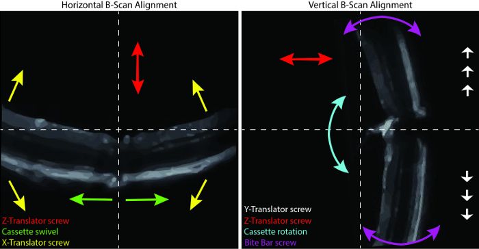 figure-results-1 Horizontal and Vertical B-Scan Alignment diagram; includes screws for translational and rotational adjustments.