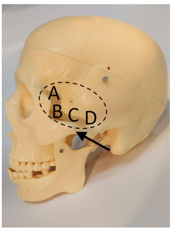 Functional Imaging of Cerebral Blood Flow Using Transcranial Doppler ...