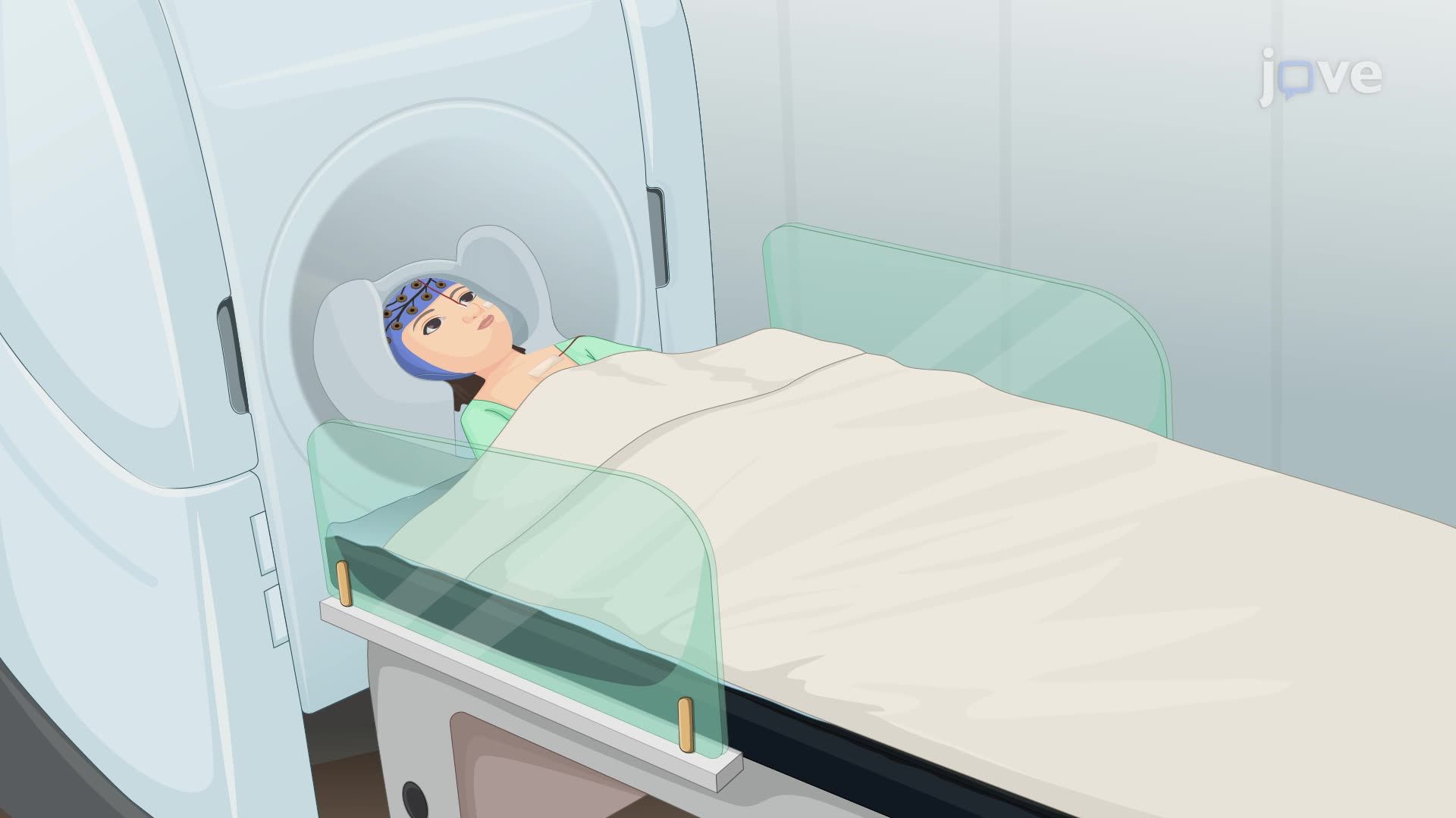  Simultaneous Electroencephalography and Magnetoencephalography to Identify Seizure-Prone Brain Regions 