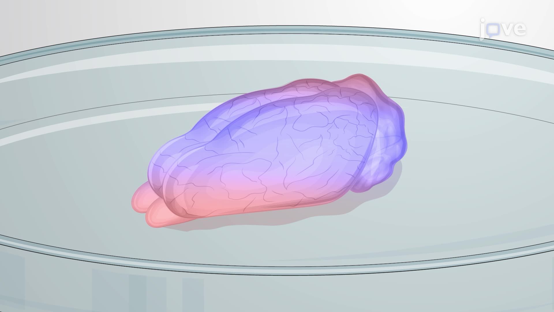 Magnetic Resonance Elastography for Assessing Viscoelastic Properties