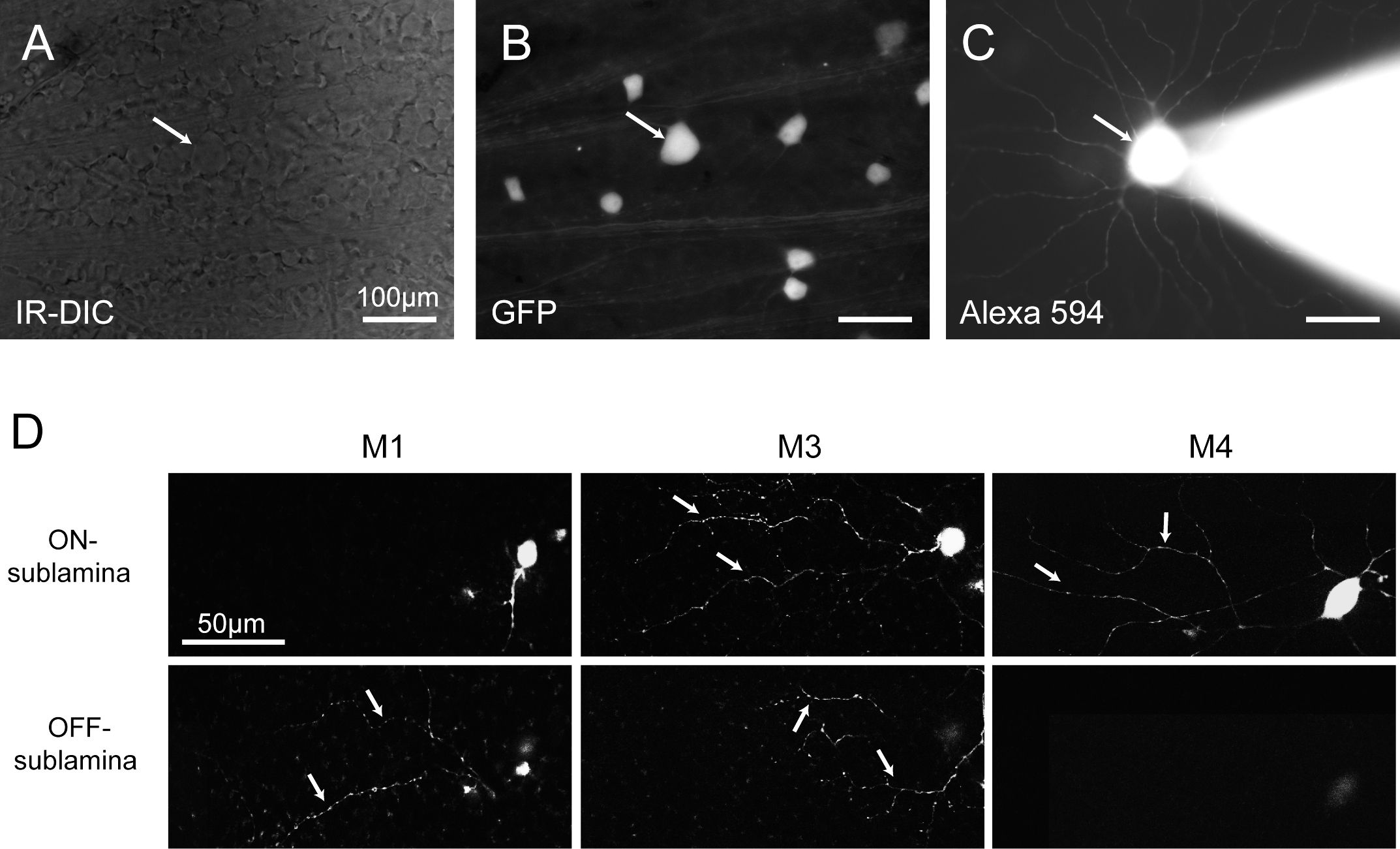 Microscopy analysis of neural samples using IR-DIC, GFP, and Alexa 594 staining in imaging study.
