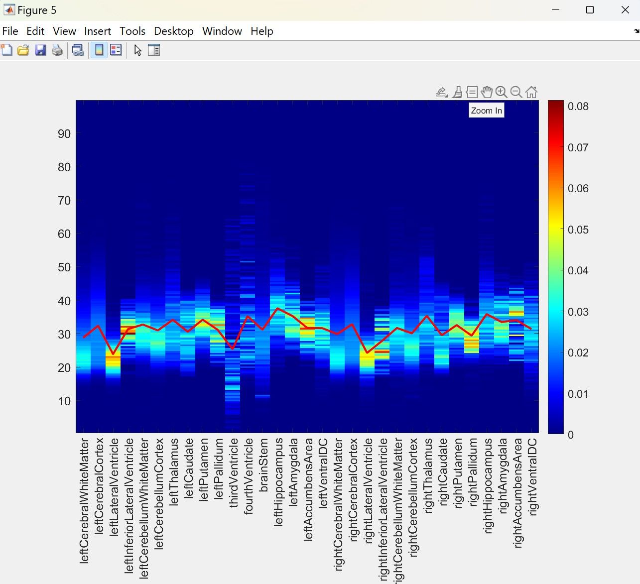Developing a Cerebral Blood Flow Atlas for Blood Flow Mapping