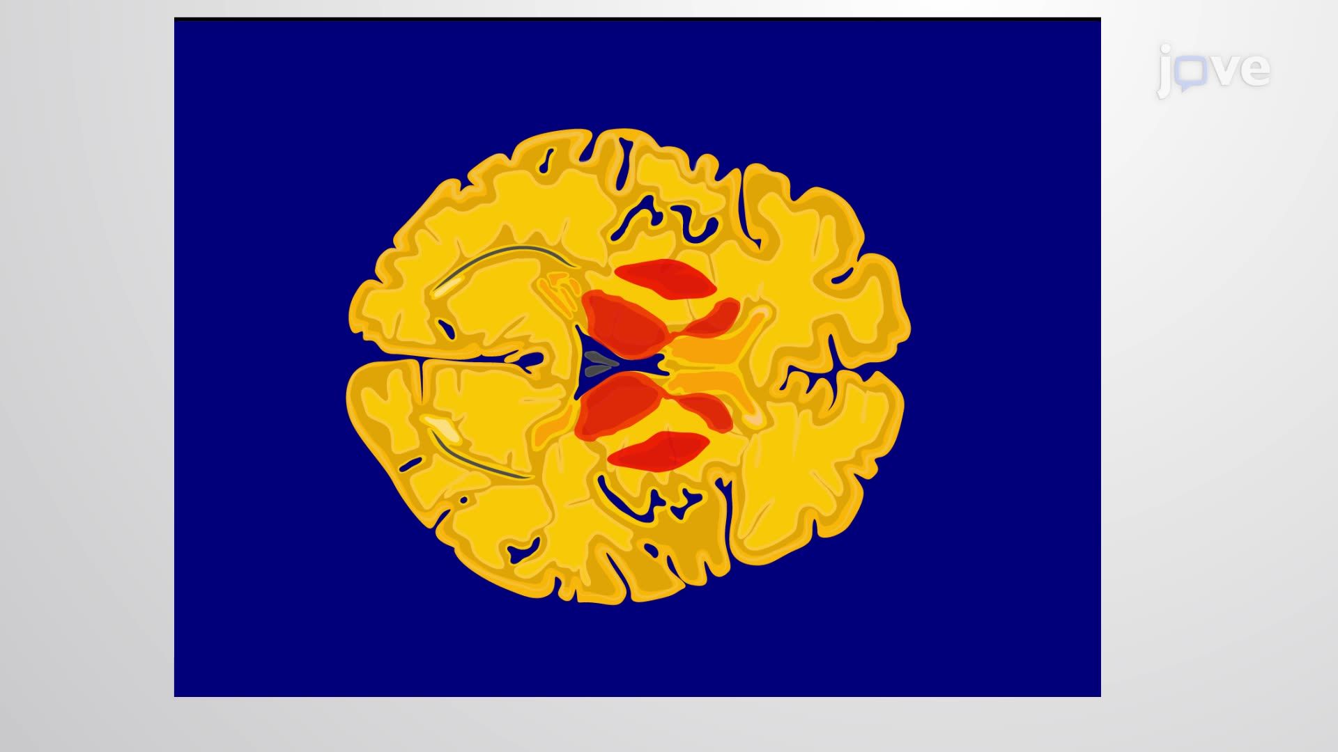 Developing a Cerebral Blood Flow Atlas for Blood Flow Mapping