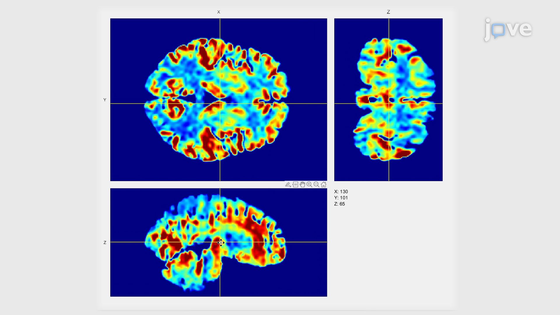 视频: Developing a Cerebral Blood Flow Atlas for Blood Flow Mapping - 实验